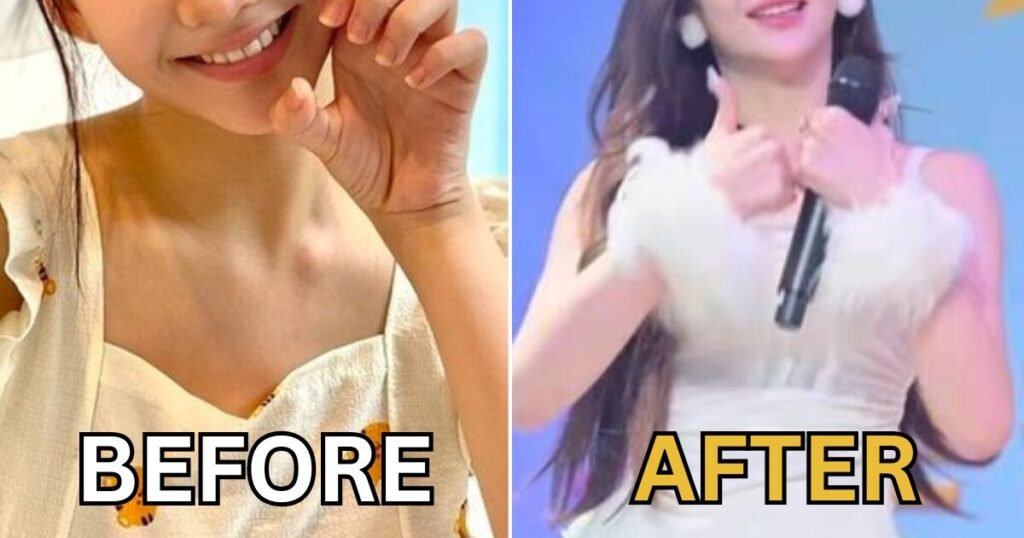 15-Year-Old Idol Accused Of Plastic Surgery — Aging Visuals Spark Heartbreak