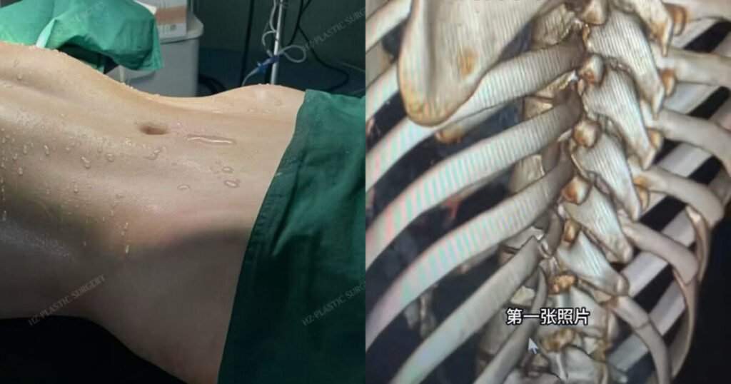 Emerging Plastic Surgery Trend In China Triggers Massive Backlash