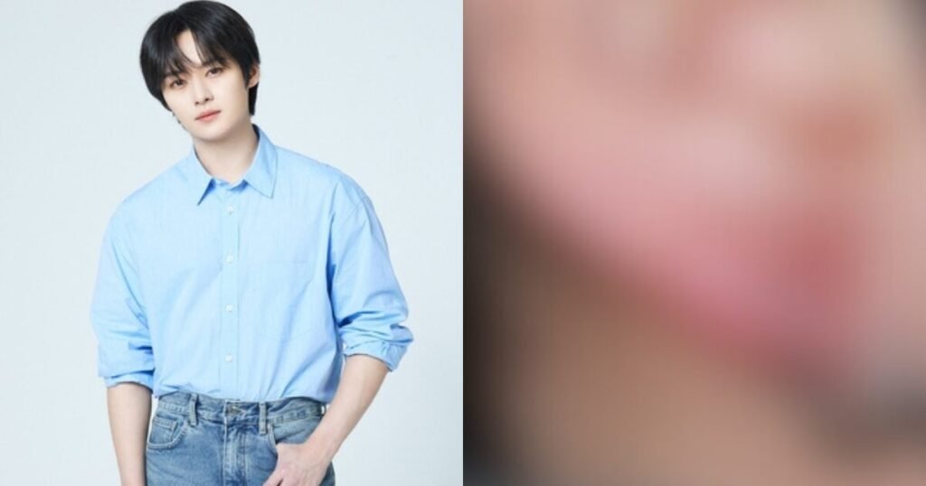 Stray Kids' Member Spotted With Fresh Injury At Airport