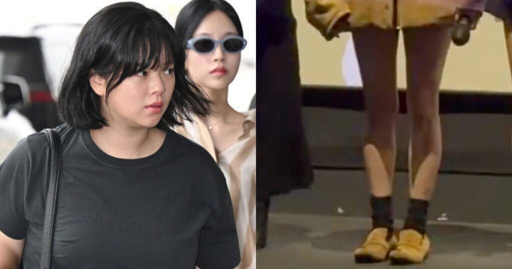 TWICE Jeongyeon's Body Transformation Sparks Debate On Weight Loss Drugs