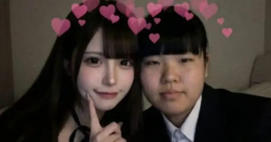 Creepy "Before And After" Plastic Surgery Photos Spark Mixed Opinions