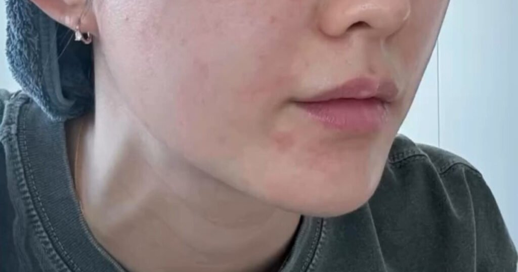 "I'm So Stressed" — Korean Actress Shares Terrible Skin Condition During Pregnancy