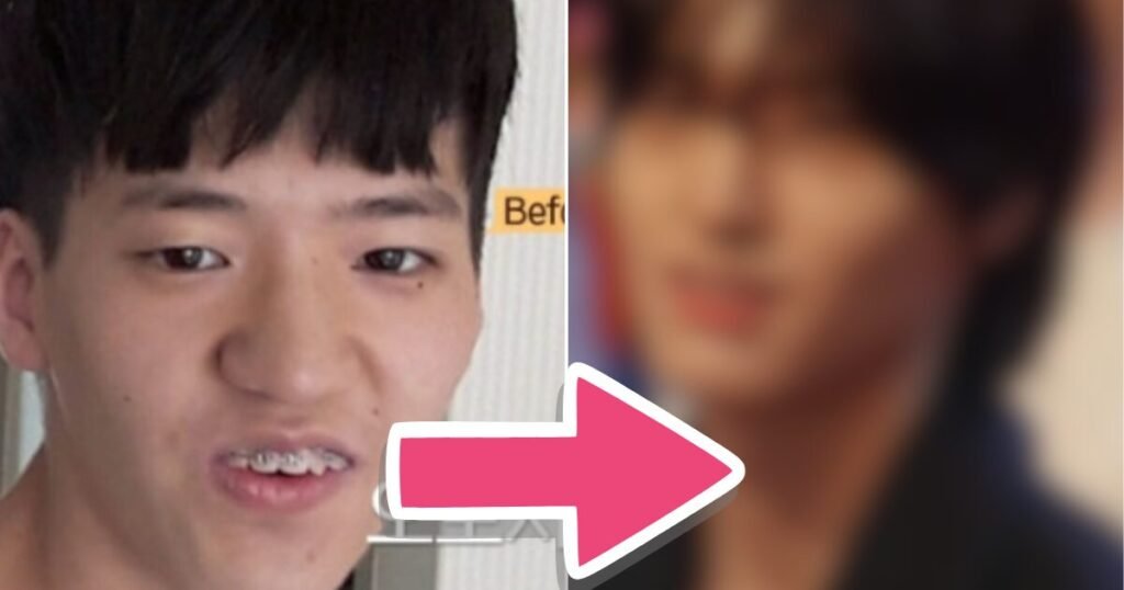 Korean Man Goes Viral For Insane No Plastic Surgery Transformation