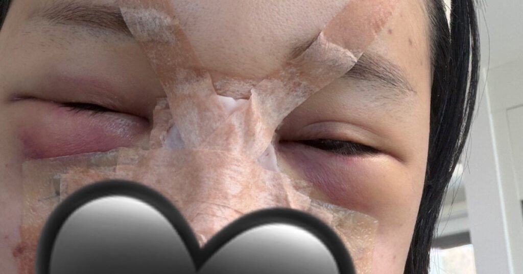 Korean Star Boldly Reveals Her Face Right After Plastic Surgeries