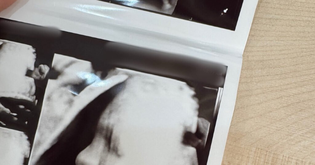 Korean Star Shares Her Current Status After Falling While Seven Months Pregnant