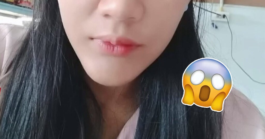 What A Woman With Four Eyebrows Had To Do To Have A Normal Life Again