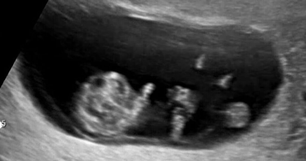 3rd Gen Girl Group Idol Announces Premarital Pregnancy