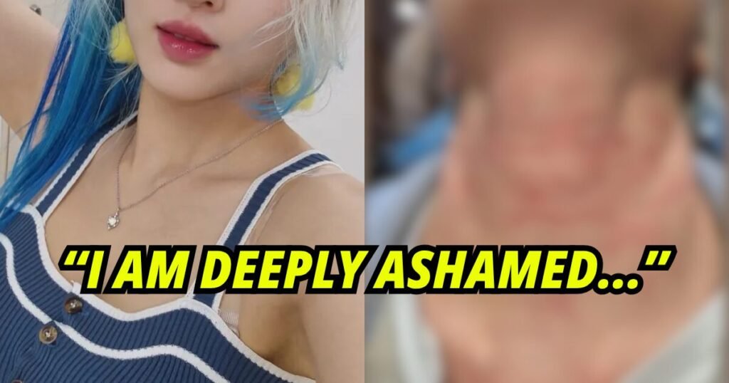 Girl Group Member Posts Heartbreaking Photos Of Her “Attack” Wounds, Company Contradicts Her Story Girl Group Member Posts Heartbreaking Photos Of Her "Attack" Wounds, Company Contradicts Her Story