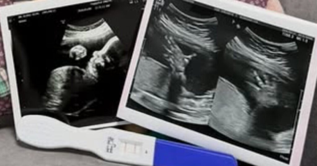 Model-Turned-TV Personality Reveals She’s Expecting Just Two Months Into Marriage Model-Turned-TV Personality Reveals She's Expecting Just Two Months Into Marriage