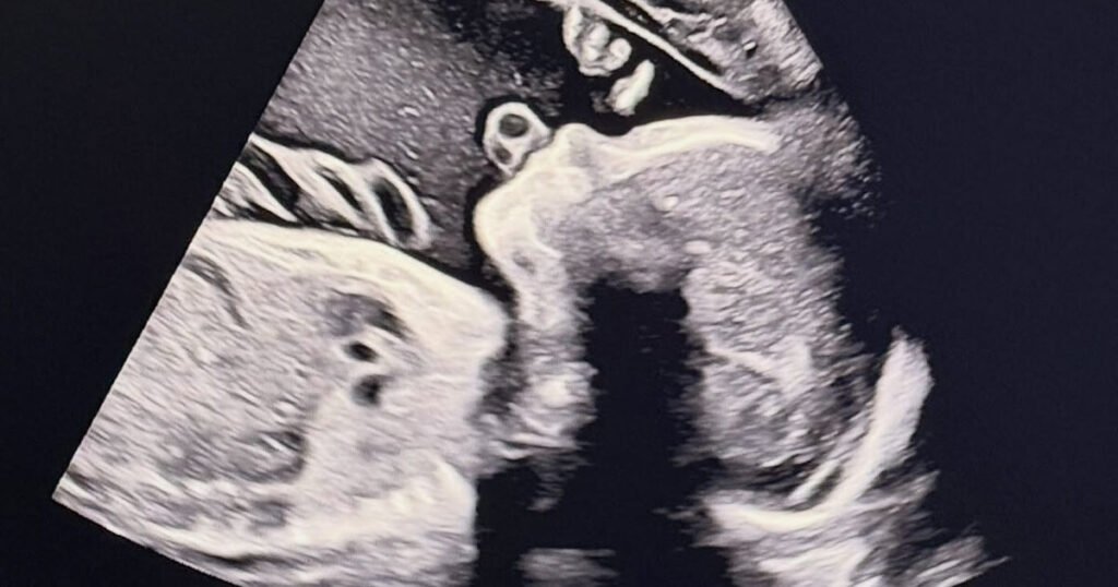 Idol-Turned-Actor Expecting First Child After Sudden Retirement And Departure From Korea