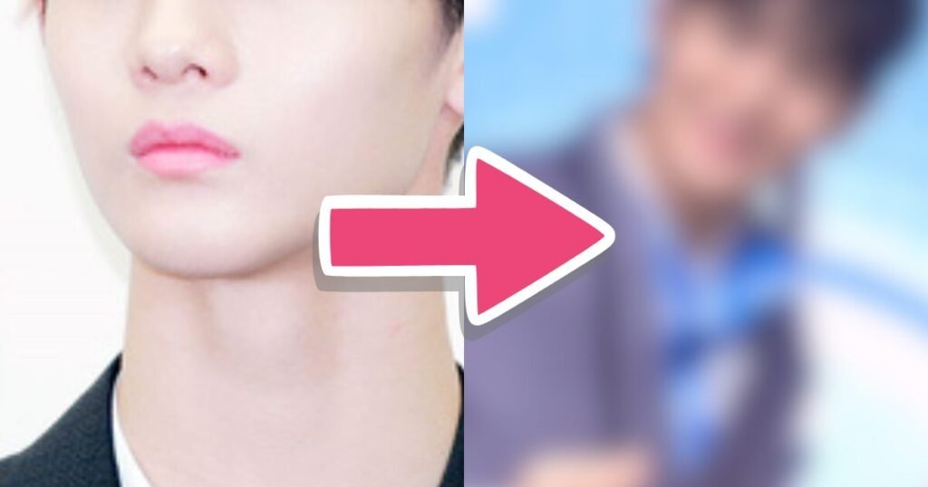 Netizens Accuse Top 3rd Gen Idol Of "Off-Putting" Plastic Surgery