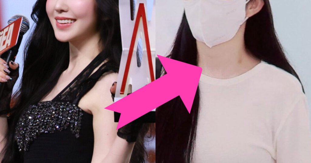 Popular SM Female Idol’s Alleged Hickey On Neck Triggers Massive Response
