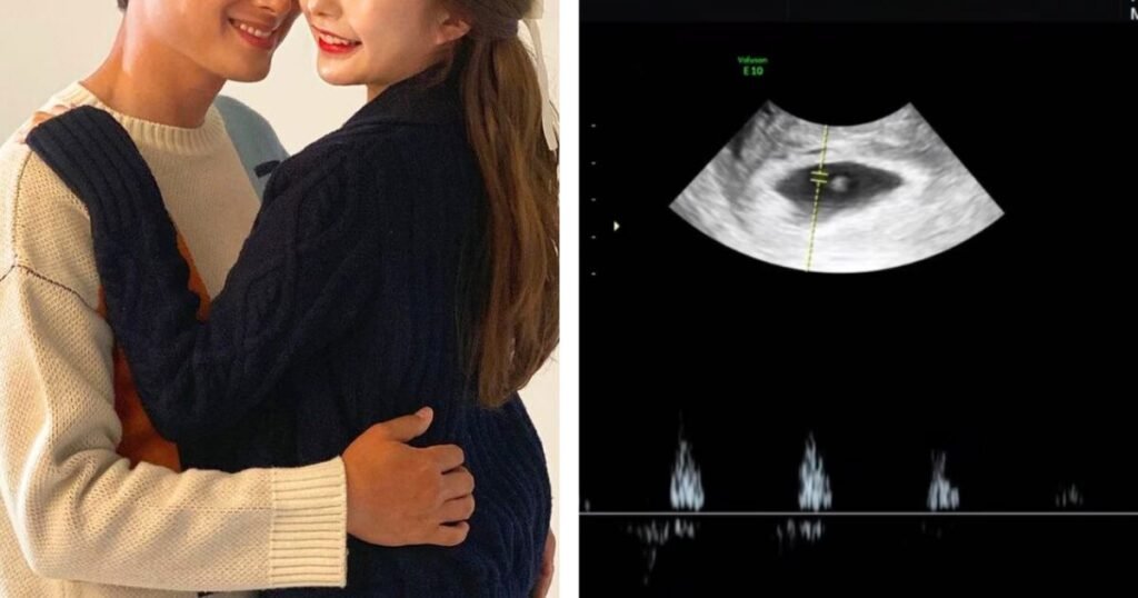 Star Couple Announce Pregnancy Following Heartbreaking Losses