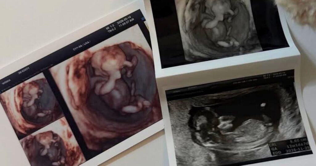 21-Year-Old Active Musician Announces Premarital Pregnancy