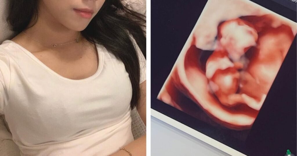 3rd Gen Idol Makes Viral Pregnancy Announcement 3rd Gen Idol Makes Viral Pregnancy Announcement