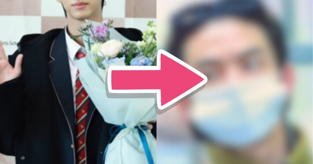 Fans Accuse HYBE Idol Of Getting Hair Transplant