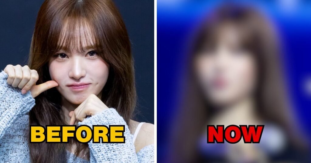IVE’s Liz Gets Alleged Plastic Surgery Mid-Tour, Sparking Heated Debate 