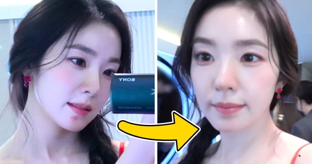 Red Velvet's Irene Gets Rid Of Huge Pimple In Real Time... And Shows It All On Cam!