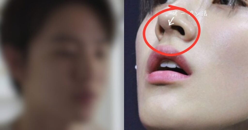 CORTIS’ Visual Member Accused Of Plastic Surgery CORTIS' Visual Member Accused Of Plastic Surgery