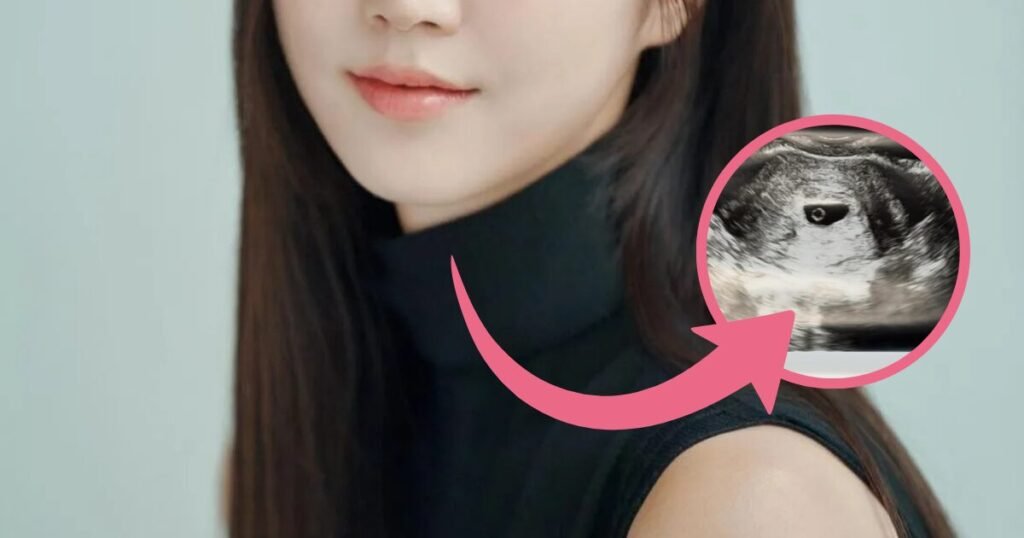 Former Top Girl Group Member Makes Surprise Pregnancy Announcement