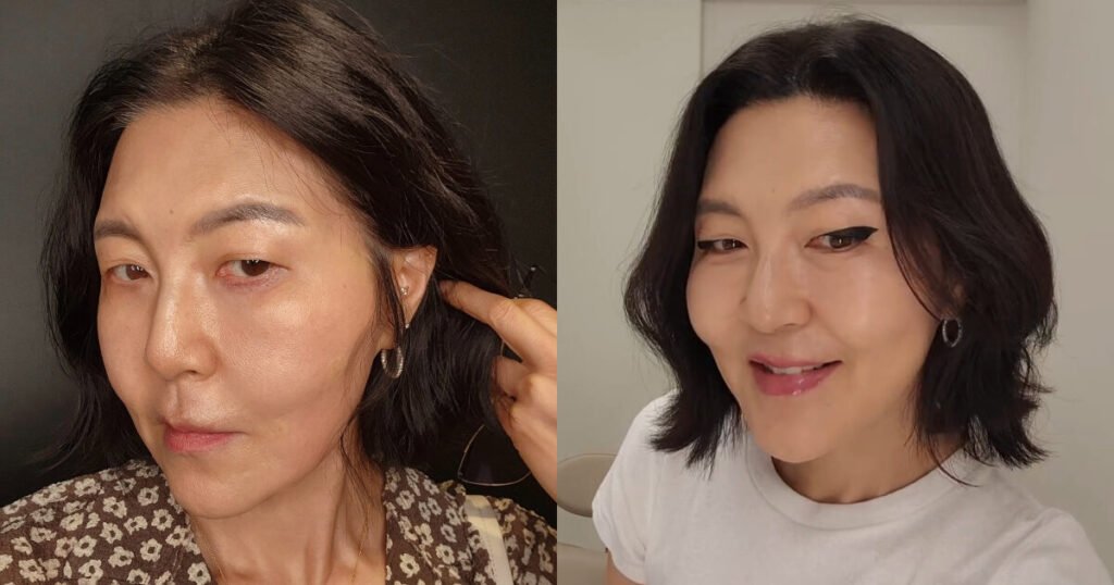 Korean Celeb Shocks With Changed Appearance After Cosmetic Procedure