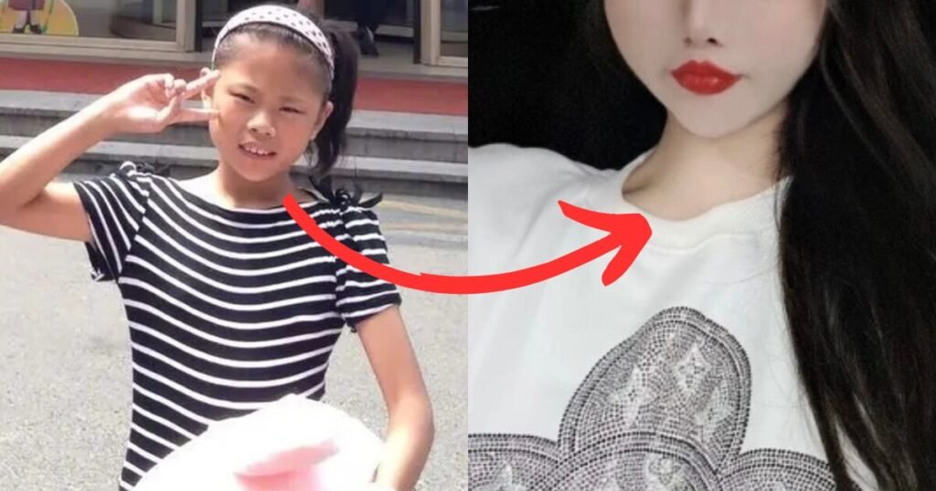 "Ruined Her Face" — The Controversial Decision To Allow A 13-Year-Old To Get Plastic Surgery