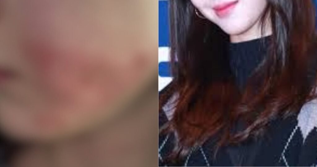 Top Girl Group Member Reveals Disturbing Update On Botched Cosmetic Procedure