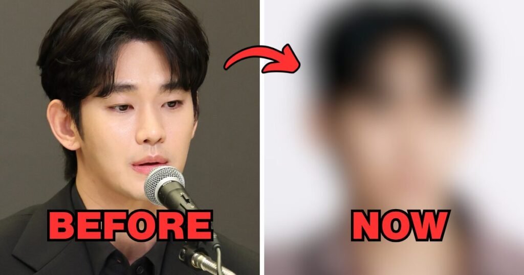 Kim Soo Hyun's Changed Appearance Sparks Plastic Surgery Accusations 