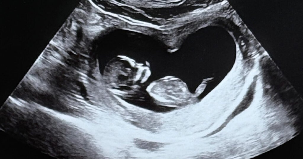 Korean Star Couple Surprises With Pregnancy News