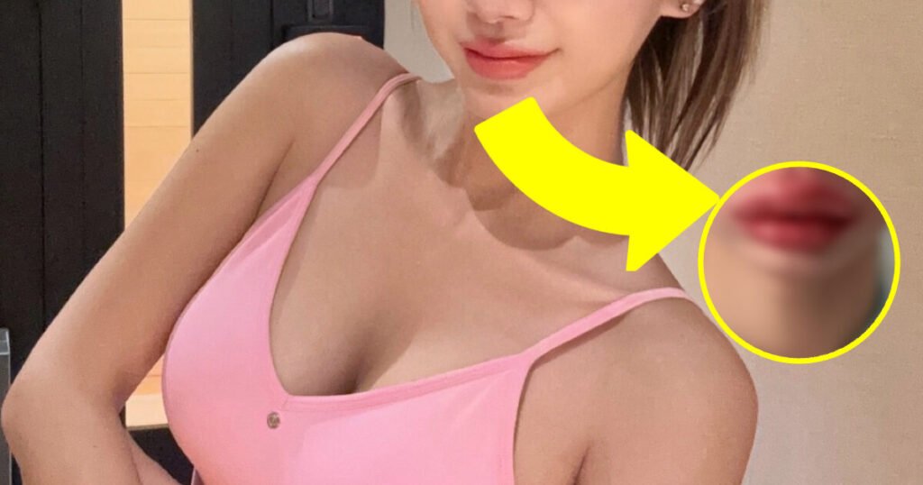 Korean Star Shocks With Photo After Cosmetic Procedure Korean Star Shocks With Photo After Cosmetic Procedure