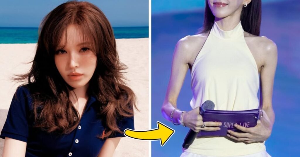 Red Velvet Wendy’s “Real” Appearance Sparks Massive Shock And Concern Red Velvet Wendy's "Real" Appearance Sparks Massive Shock And Concern