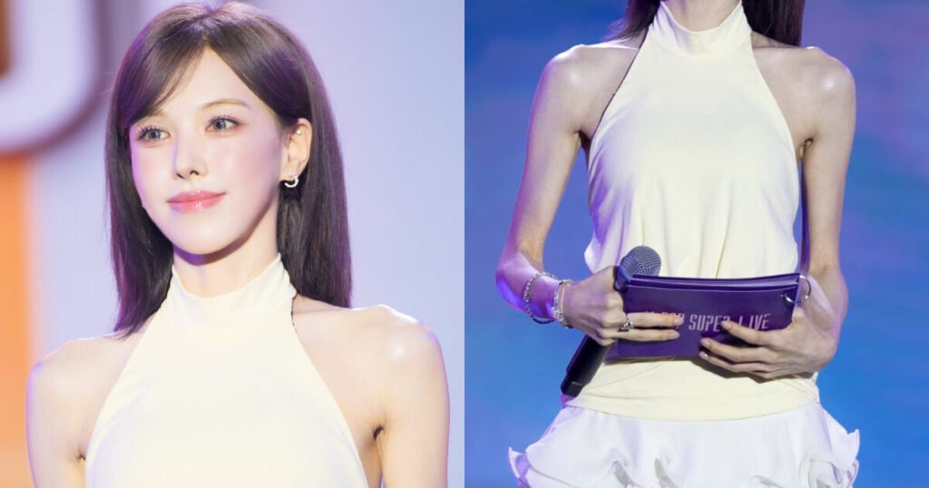 Red Velvet’s Wendy Reveals Reason For Sudden Dramatic Weight Loss