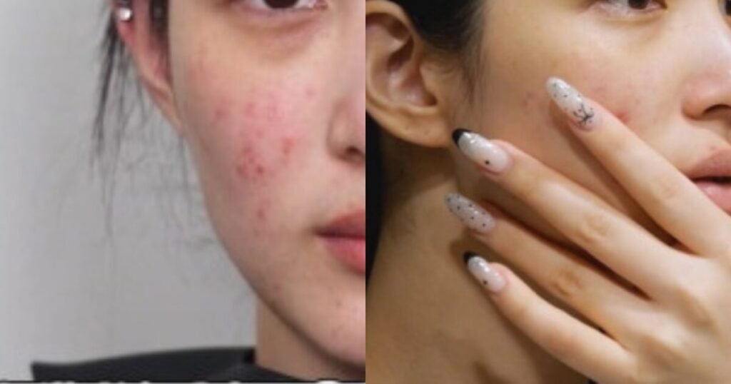 3rd Gen Girl Group Member Reveals Shocking Bare Face