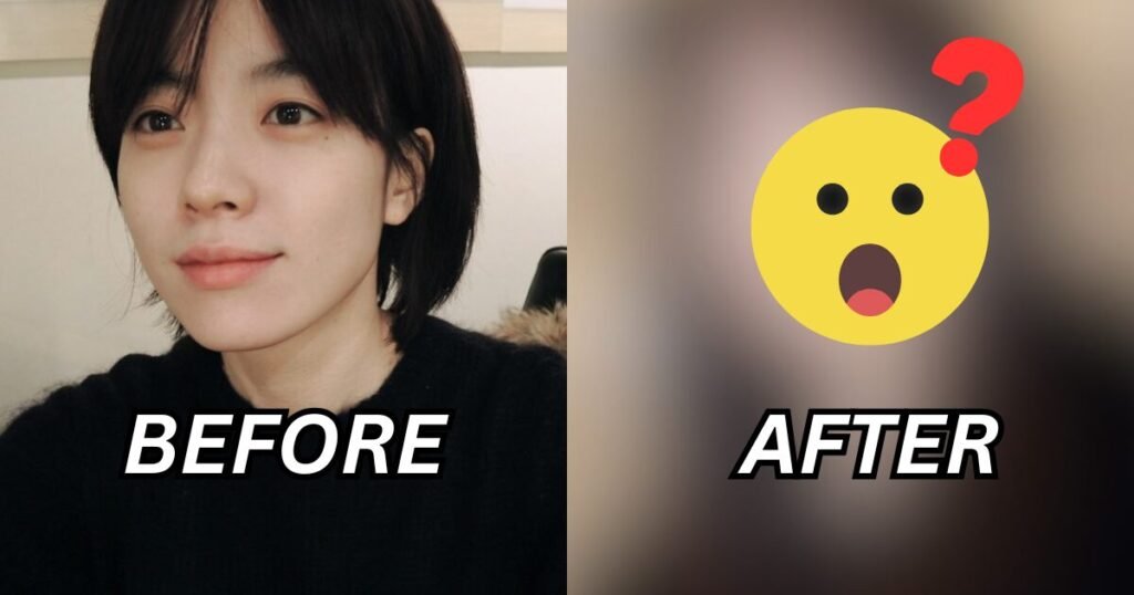 Actress Han Hyo Joo Faces Allegations Of Surgically Altering Her Face