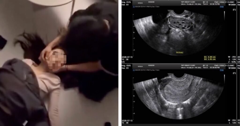 Netflix Actor's Alleged Ex-Girlfriend Shares Startling Proof Of His Abusive Behavior + Forced Abortion