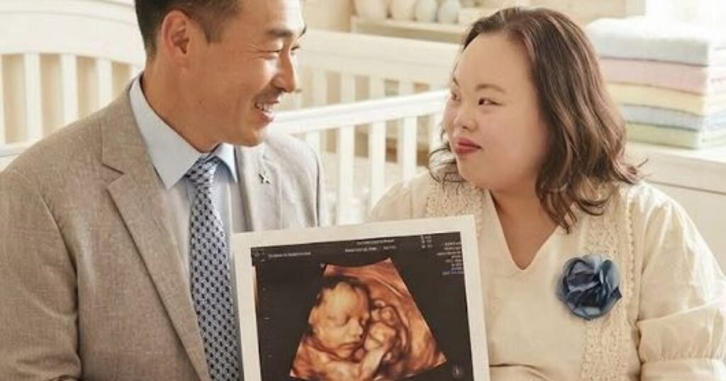 Famous Actress With Down Syndrome Shocks With Ultrasound Image Famous Actress With Down Syndrome Shocks With Ultrasound Image