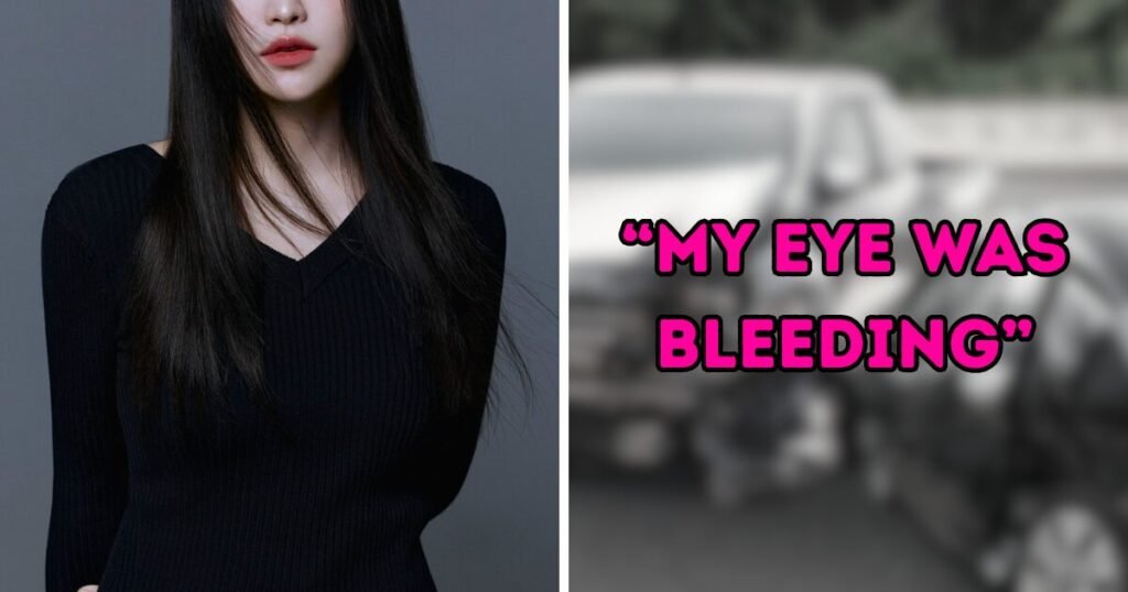 Red Velvet Star Exposes Horrific Car Accident SM Entertainment Kept Secret For 10 Years