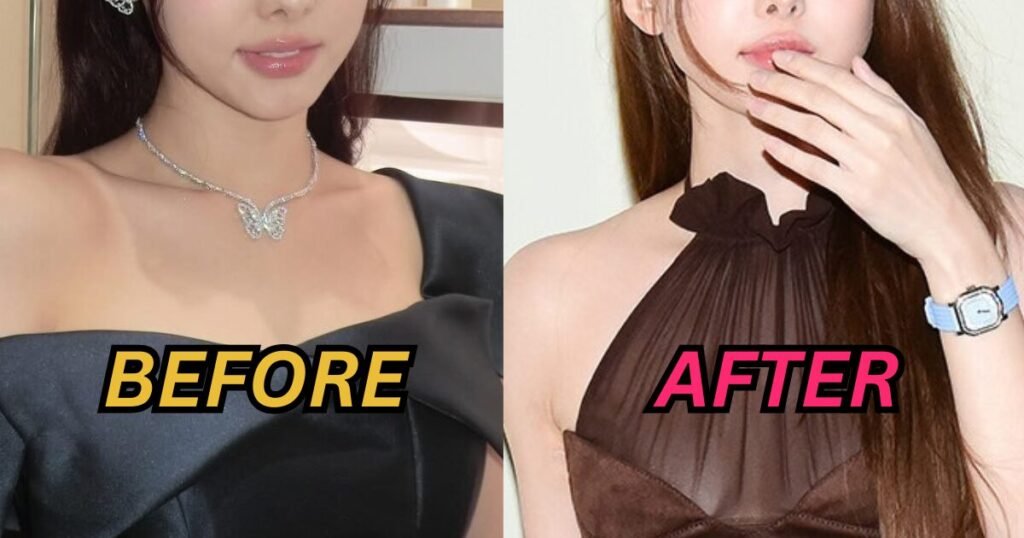 Top Girl Group Idol Catches Plastic Surgery Accusations After Recent Public Appearance Top Girl Group Idol Catches Plastic Surgery Accusations After Recent Public Appearance