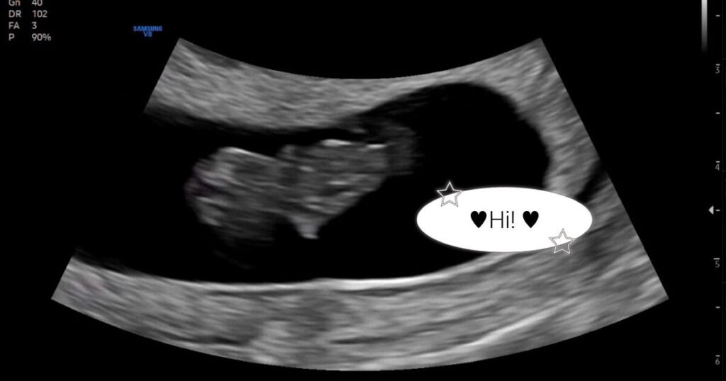 Beloved Korean Actor Couple Announces Pregnancy Beloved Korean Actor Couple Announces Pregnancy