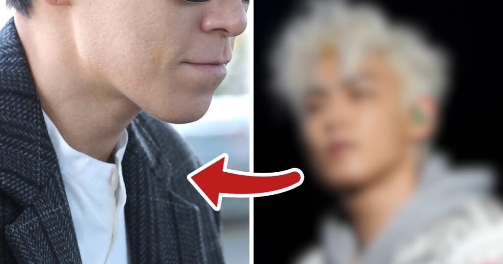 Popular Idol's Aging Visuals Hit With Brutal Reactions